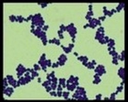 Gram-stained smear of S.aureus from culture